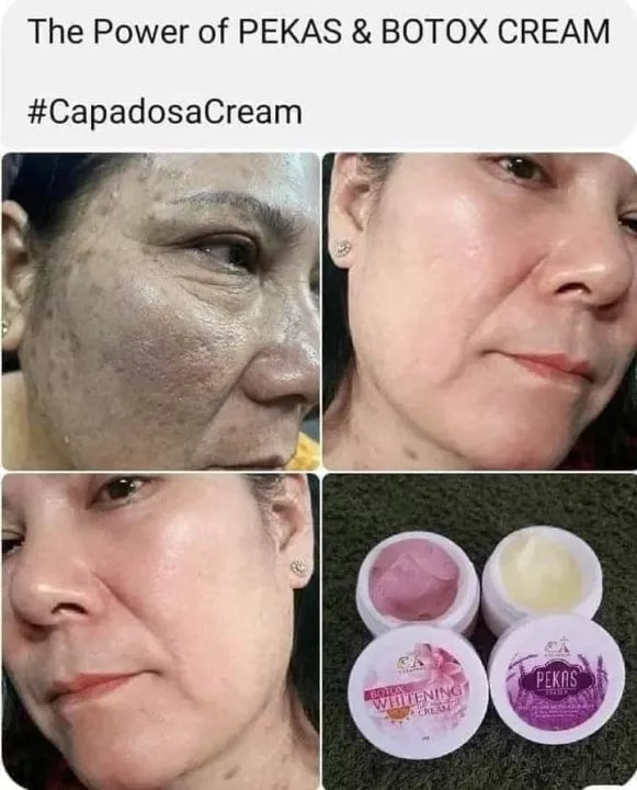 Capadosa Pekas Eraser Cream 10g